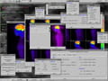 Logiciel imagerie medicale gratuit